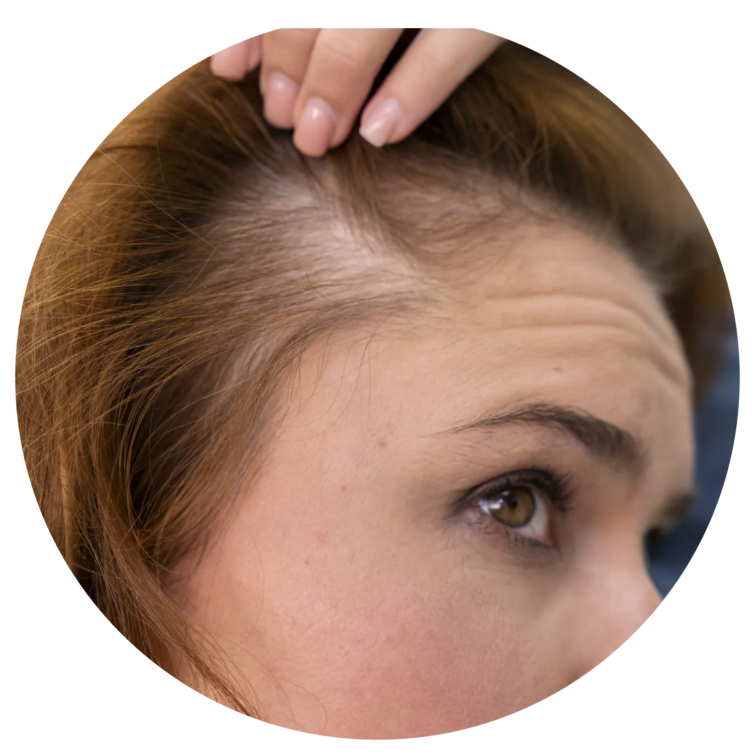 Hair Loss treatment process at Toronto medical spa - Understand the deeper roots of the hair loss